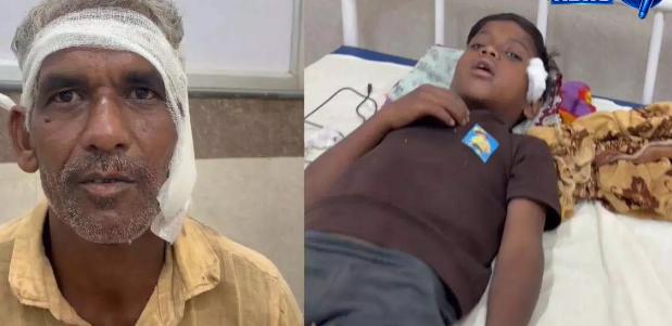 Chhattisgarh: मरवाही में पागल कुत्ते का आतंक, 3 बच्चों समेत 6 लोगों को काटा