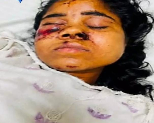 रेल हादसे में घायल मुंगेली की युवती सिम्स में भर्ती, परिजनों की तलाश जारी