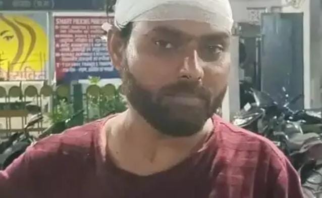 कोरबा में शराब पीने से रोकना पड़ा भारी: युवक पर 10-12 लोगों ने किया जानलेवा हमला, सिर में गंभीर चोट