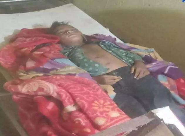 सरगुजा में आकाशीय बिजली का कहर: दो बच्चों की मौत, दो सगे भाई गंभीर रूप से झुलसे