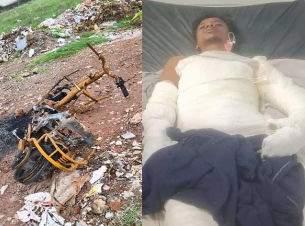 रायपुर में पेट्रोल डालकर युवक को जिंदा जलाने का आरोप, मौत के बाद भी आरोपी गिरफ्त से बाहर