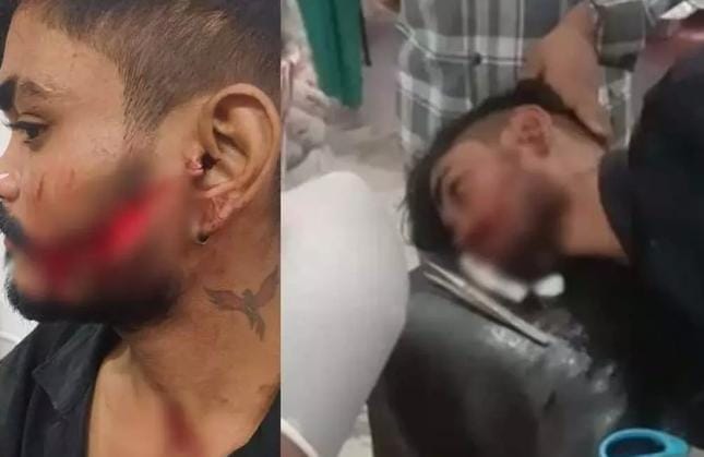 बिलासपुर में दो पक्षों के बीच खूनी झड़प, धारदार हथियार से हमला; 5 घायल, घटना का वीडियो वायरल