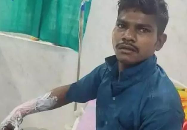 दोस्ती हुई शर्मसार: पत्नी पर टिप्पणी से नाराज युवक ने दोस्त को पेट्रोल डालकर जलाने की कोशिश